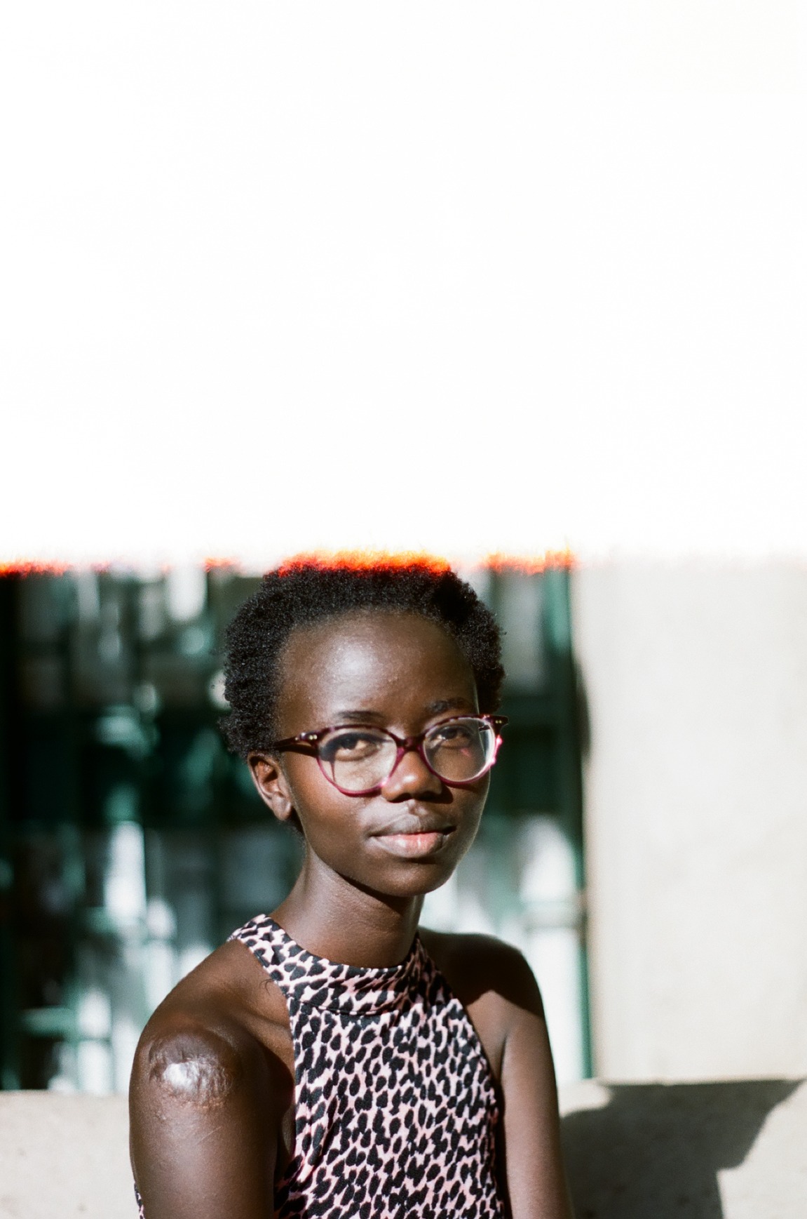 Photo portrait of young African woman wearing glasses and a leopard print top. She has a scar on her shoulder.